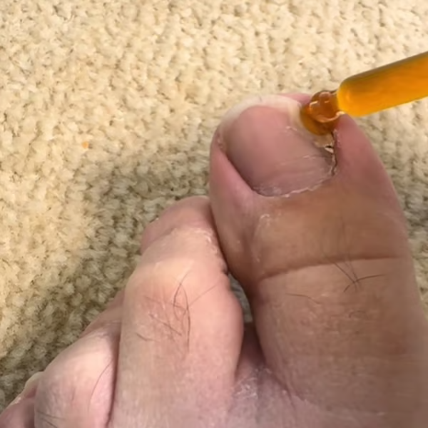 Daily Nail Care Solution