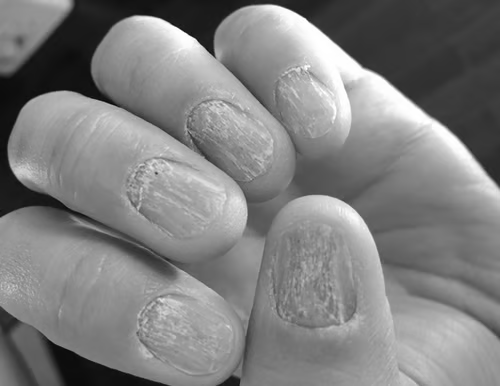 Daily Nail Care Solution
